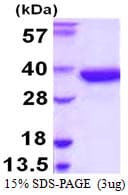 Human SULT1A2 / Sulfotransferase 1A2 Protein (Recombinant His)