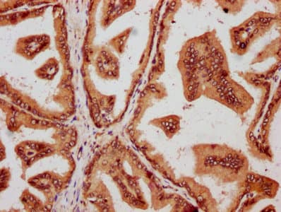 SMAD2 Antibody
