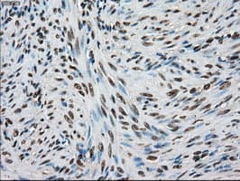 Monoclonal Mouse anti-Human TYRO3 Antibody (clone OTI2G2, IHC, WB)