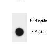 Polyclonal Rabbit anti-Human ATRIP Antibody (phospho-Ser239)