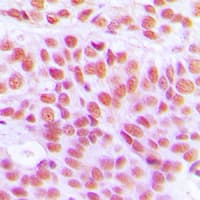 Histone H4 Antibody (Acetyl-Lys12)