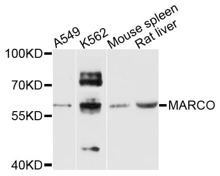 IHC-plus™ MARCO Antibody