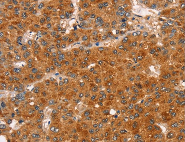 GAPIII / RASA3 Antibody