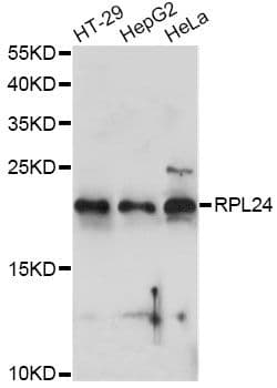 Polyclonal Rabbit anti-Human RPL24 / Ribosomal Protein L24 Antibody (WB)