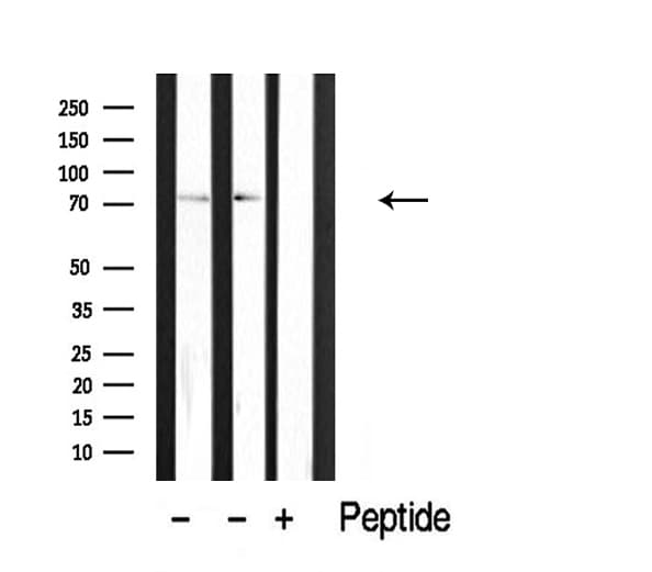 CLIP4 / RSNL2 Antibody
