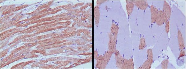MYL3 Antibody (clone 7C1)