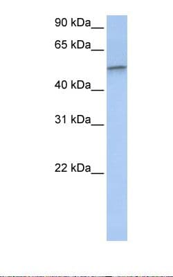 PathPlus™ Vimentin Antibody (C-Terminus)