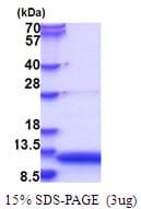 Human GNRH Protein (Recombinant His)