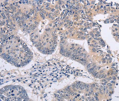 FBXO32 / Fbx32 Antibody