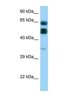 Polyclonal Rabbit anti-Human C16orf70 / LIN10 Antibody (aa255-304, WB)