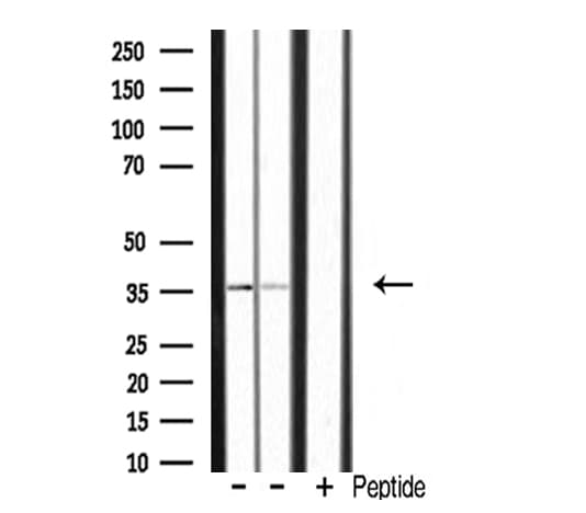 POU4F3 / BRN3C Antibody