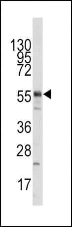 Polyclonal Rabbit anti-Human KAT5 / TIP60 Antibody (aa33-64, WB)