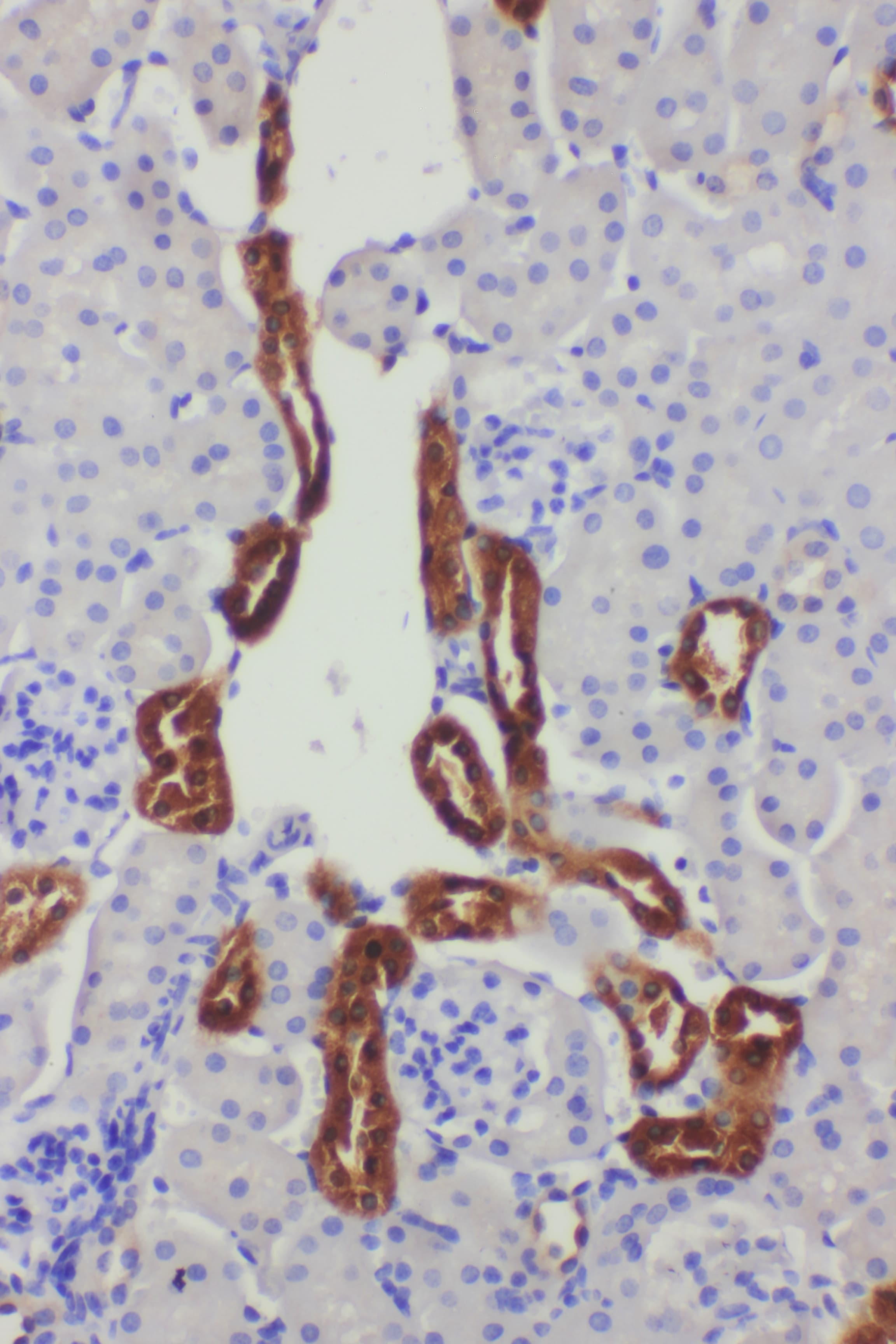 KLK1 / Kallikrein 1 Antibody (aa243-261)