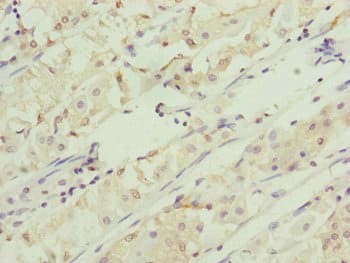 Polyclonal Rabbit anti-Human RMA1 / RNF5 Antibody (IHC, WB)