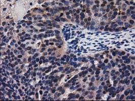 ADSL / Adenylosuccinate Lyase Antibody (clone OTI2D10)
