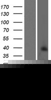 CT55 / CXorf48 Protein (Over-Expression Lysate Myc-DDK (Flag))