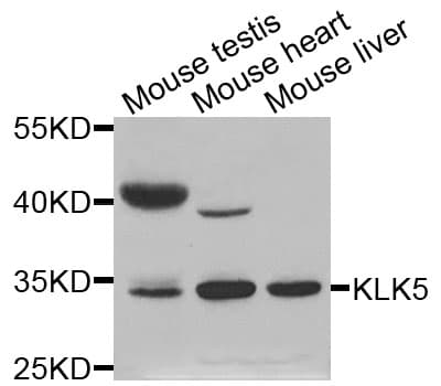 IHC-plus™ Polyclonal Rabbit anti-Human KLK5 / Kallikrein 5 Antibody (IHC, WB)