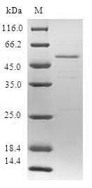 Human SSX5 Protein (Recombinant GST, N-terminus)