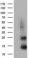 FSHB / FSH Beta Antibody (clone OTI3A9)