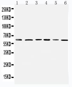 PDK1 Antibody (aa408-421)