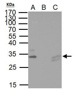 IHC-plus™ TIP30 / HTATIP2 Antibody