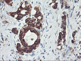 GOLM1 / GP73 / GOLPH2 Antibody (clone OTI2D6)