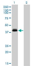 Monoclonal Mouse anti-Human OTX1 Antibody (clone 1F2, IF, WB)