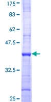 Human PFKFB4 Protein (Recombinant GST, N-terminus)