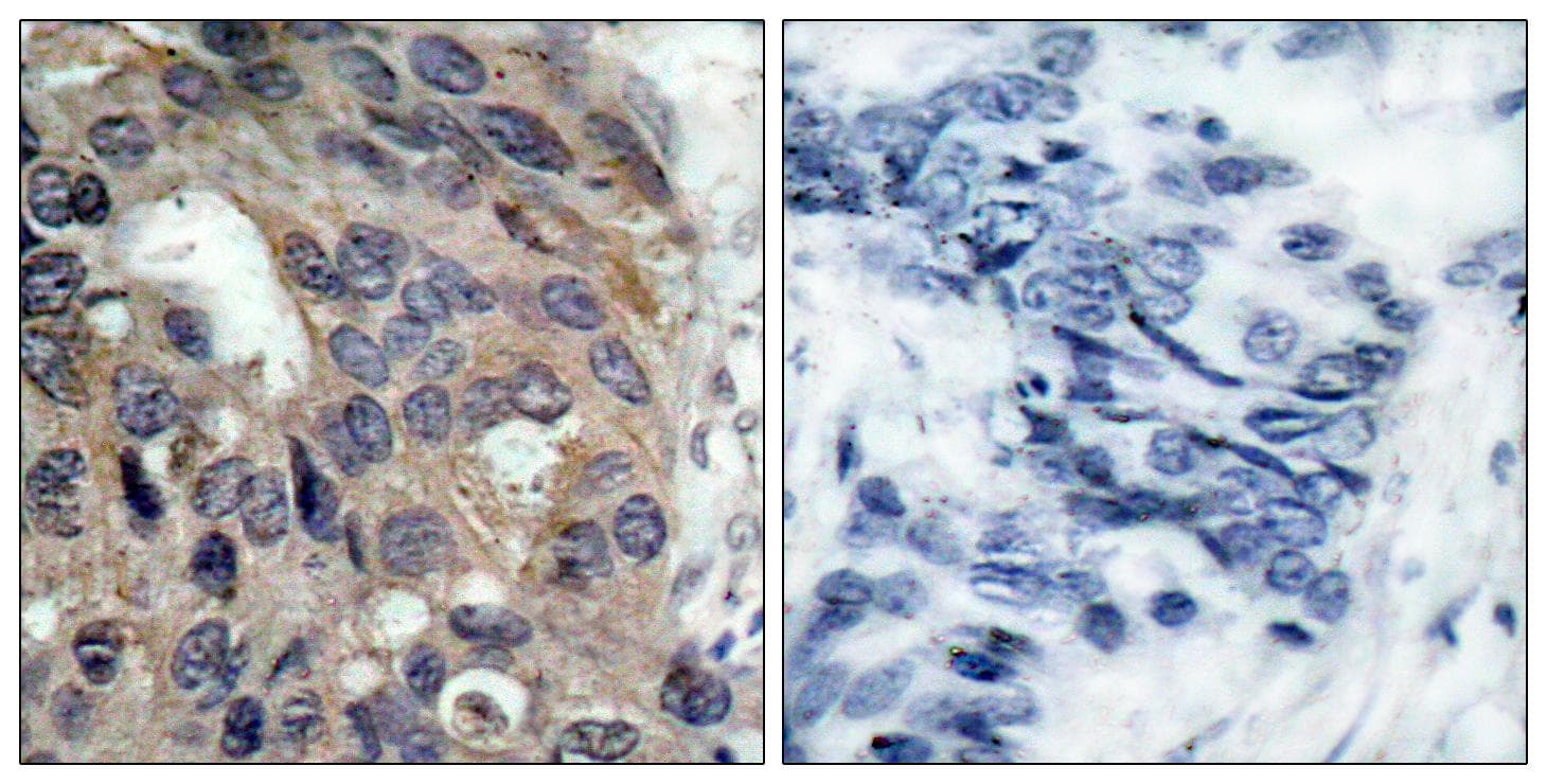 Polyclonal Rabbit anti-Human SRC Antibody (phospho-Tyr529, IHC, WB)