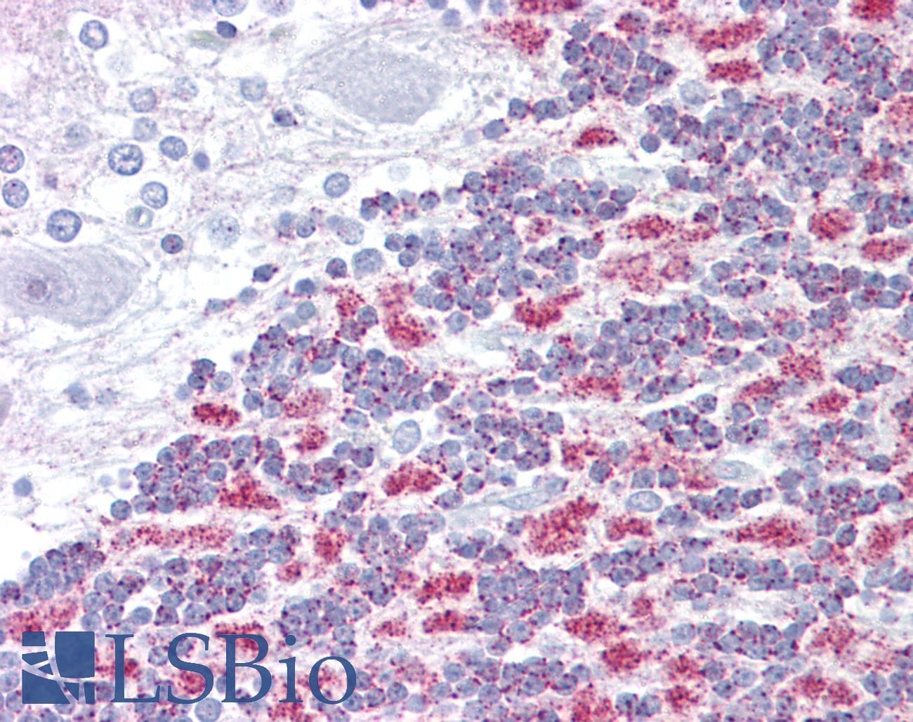 Polyclonal Rabbit anti-Human E2F2 Antibody (C-Terminus, IHC, WB)