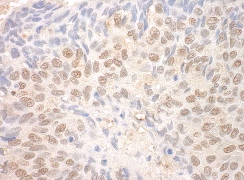 TDRD3 Antibody (aa601-651)