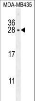 Placental Lactogen Antibody (aa177-204)