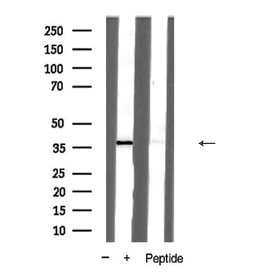 PAWR / PAR4 Antibody