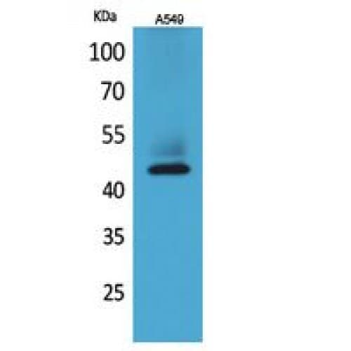 KRT19 / CK19 / Cytokeratin 19 Antibody (321-370 aa, C-terminal)