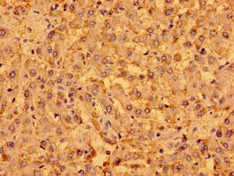 MENT / C1orf56 Antibody