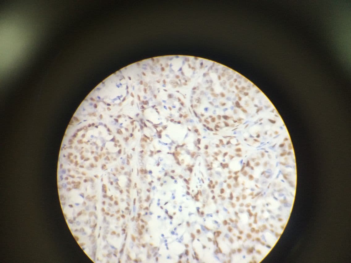 MTOR Antibody (phospho-Ser2448)