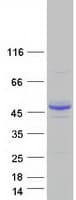 Human ALG2 Protein (Recombinant Myc-DDK (Flag))