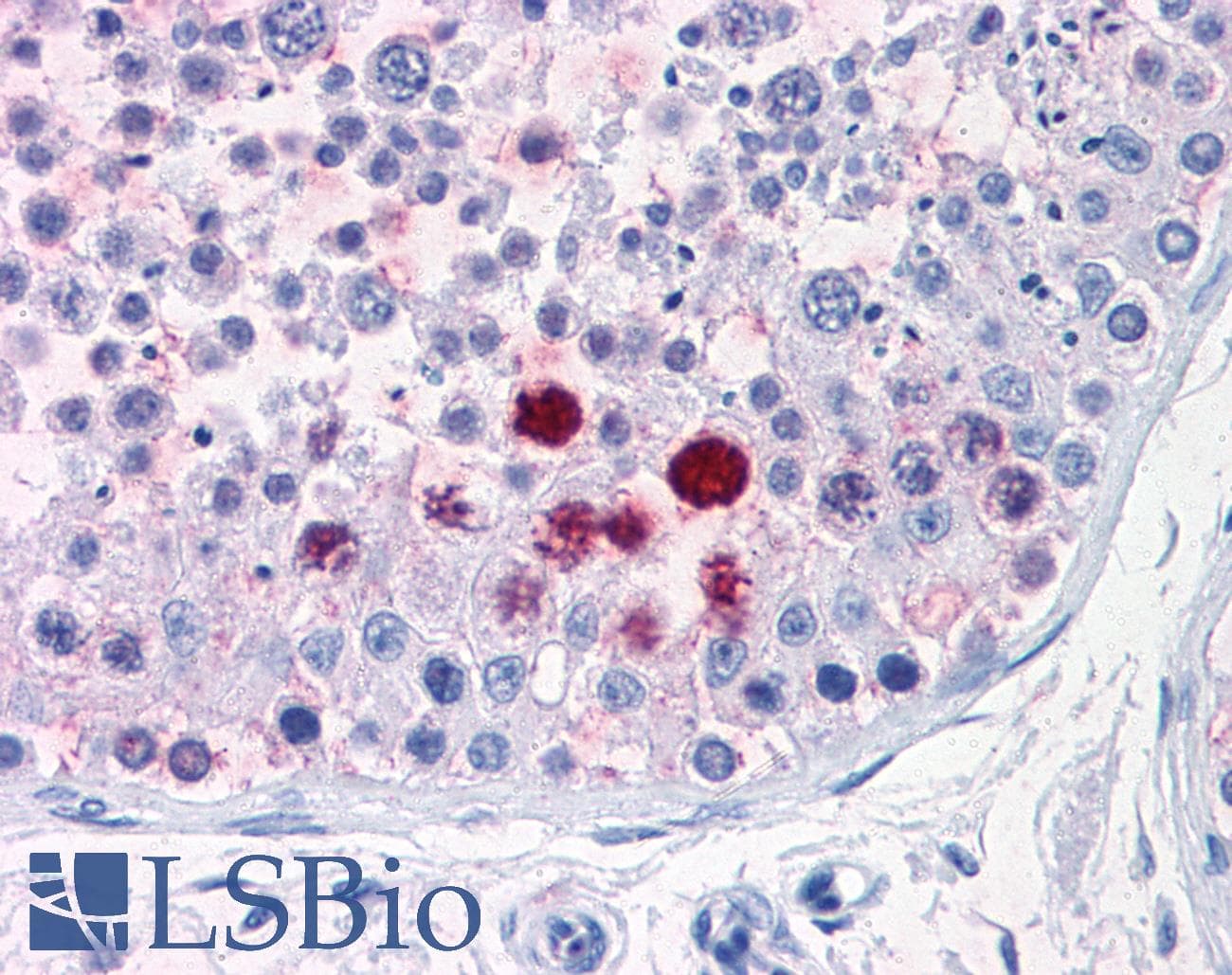 IHC-plus™ ENPP3 / CD203c Antibody (C-Terminus)