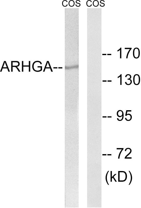 ARHGEF10 / GEF10 Antibody