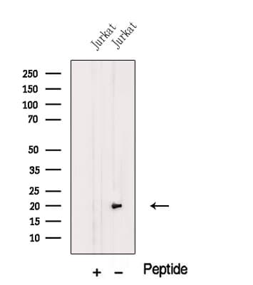 MFAP5 / MAGP2 Antibody