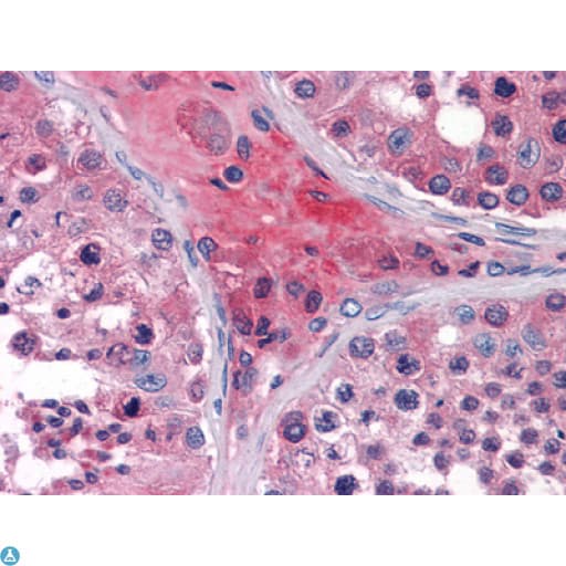 APOO / Apolipoprotein O Antibody