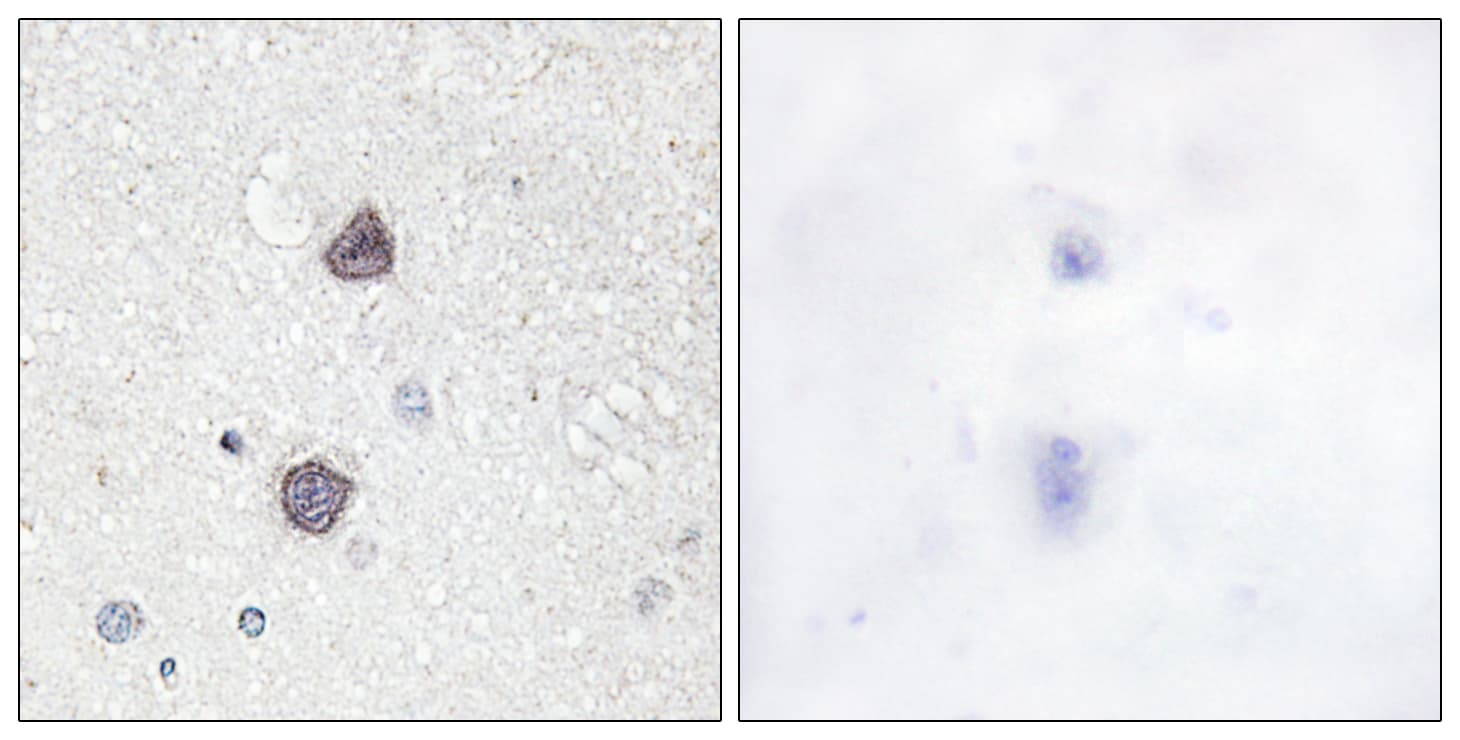 Polyclonal Rabbit anti-Human AQP2 / Aquaporin 2 Antibody (phospho-Ser256, IHC)