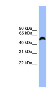MARCO Antibody (aa370-419)