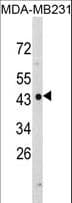 NDRG1 Antibody (aa12-40)