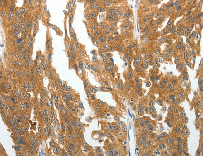 Polyclonal Rabbit anti-Human RGS2 Antibody (IHC)