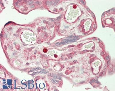 PathPlus™ CTNND1 / p120 Catenin Antibody (aa891-C-term)