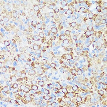 Polyclonal Rabbit anti-Human HTRA3 Antibody (IHC, WB)