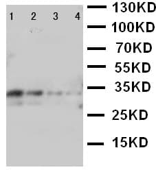 LTK Antibody (aa850-864)