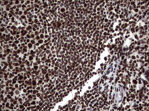 HNRNPL / hnRNP L Antibody (aa270-502, clone OTI2E4)