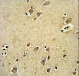 Polyclonal Rabbit anti-Human DIRAS3 / ARHI Antibody (IHC, WB)